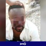 penye:-stevens-jeanty-is-in-great-difficulty-with-2-of-his-eyes-after-bandit-bullets-blew-him-away