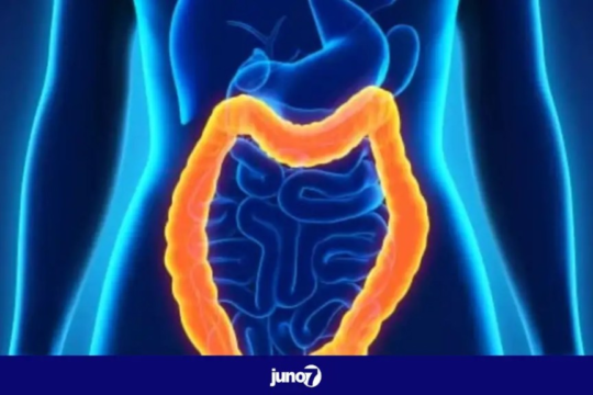 a-gastroenterologist-presents-symptoms-suggestive-of-colon-cancer