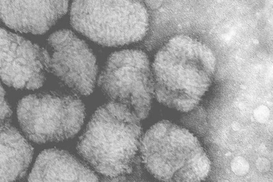 alaskapox:-what-we-know-about-the-first-fatal-case-due-to-this-recently-discovered-virus