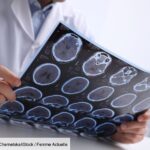 brain-cancer:-this-promising-new-treatment-could-be-effective-against-glioblastoma