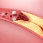 what-are-the-effects-of-cholesterol-on-the-body?