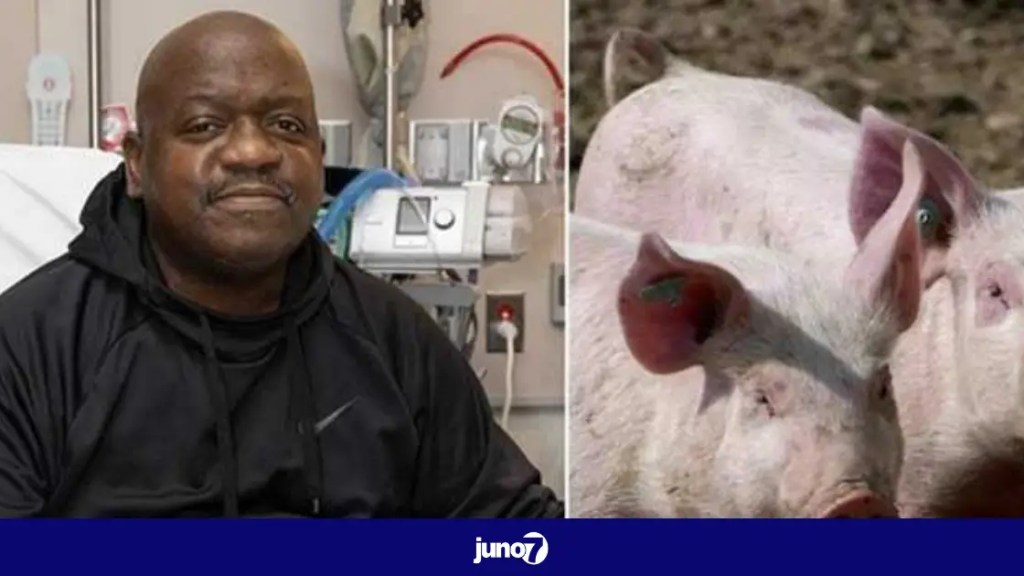 united-states:-death-of-the-first-patient-who-received-a-pig-kidney