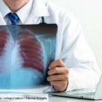 lung-cancer:-what-is-this-promising-treatment-that-would-lead-to-improved-survival?