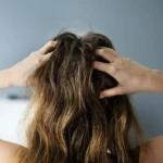 itchy-scalp:-what-are-the-causes?